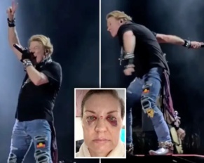 Fan golpeada por el micrófono de [Axl Rose], aquí vamos otra vez…