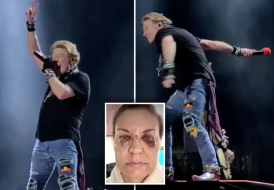 Fan golpeada por el micrófono de [Axl Rose], aquí vamos otra vez…