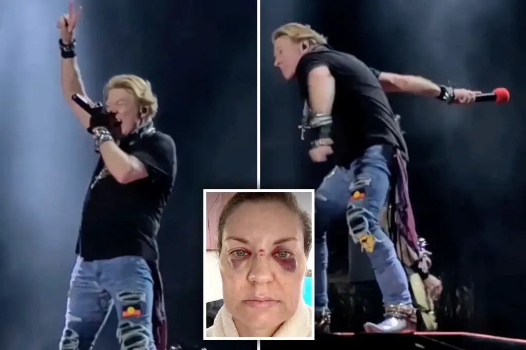 Fan golpeada por el micrófono de [Axl Rose], aquí vamos otra vez…